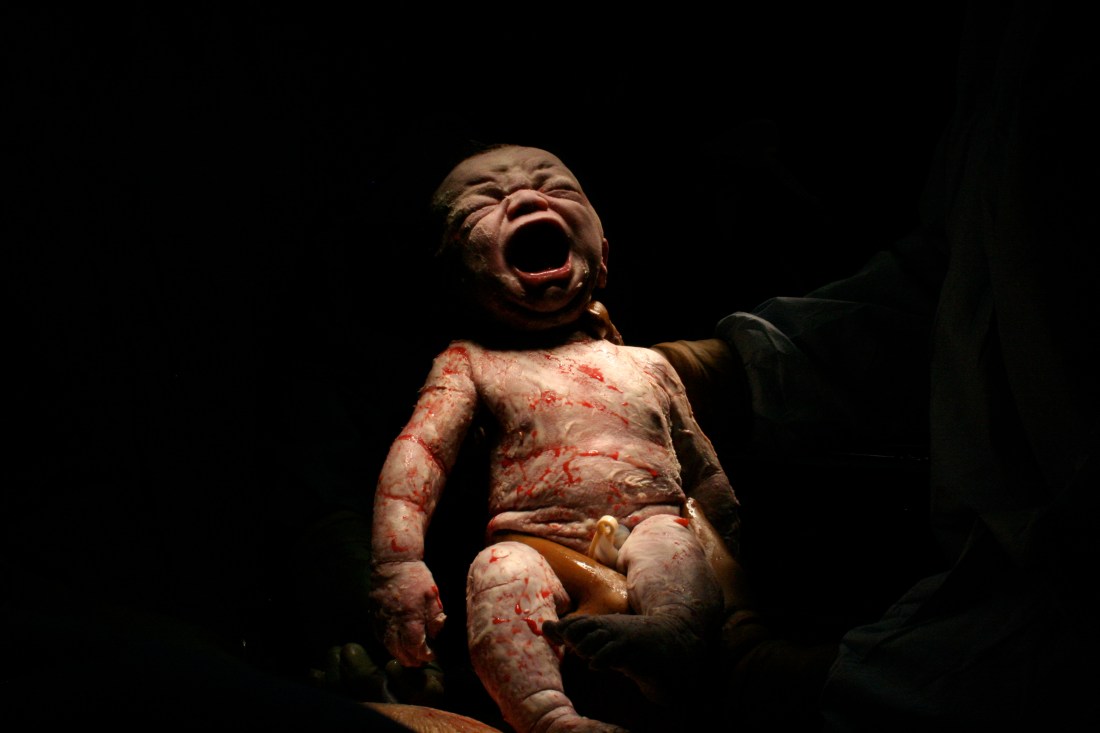 A disgusting-but-well-lit photo of EJT being born